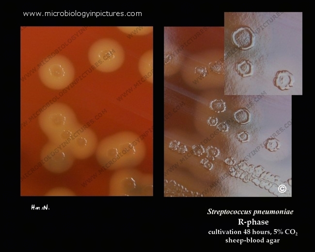 pneumococcus colony morphology, R form